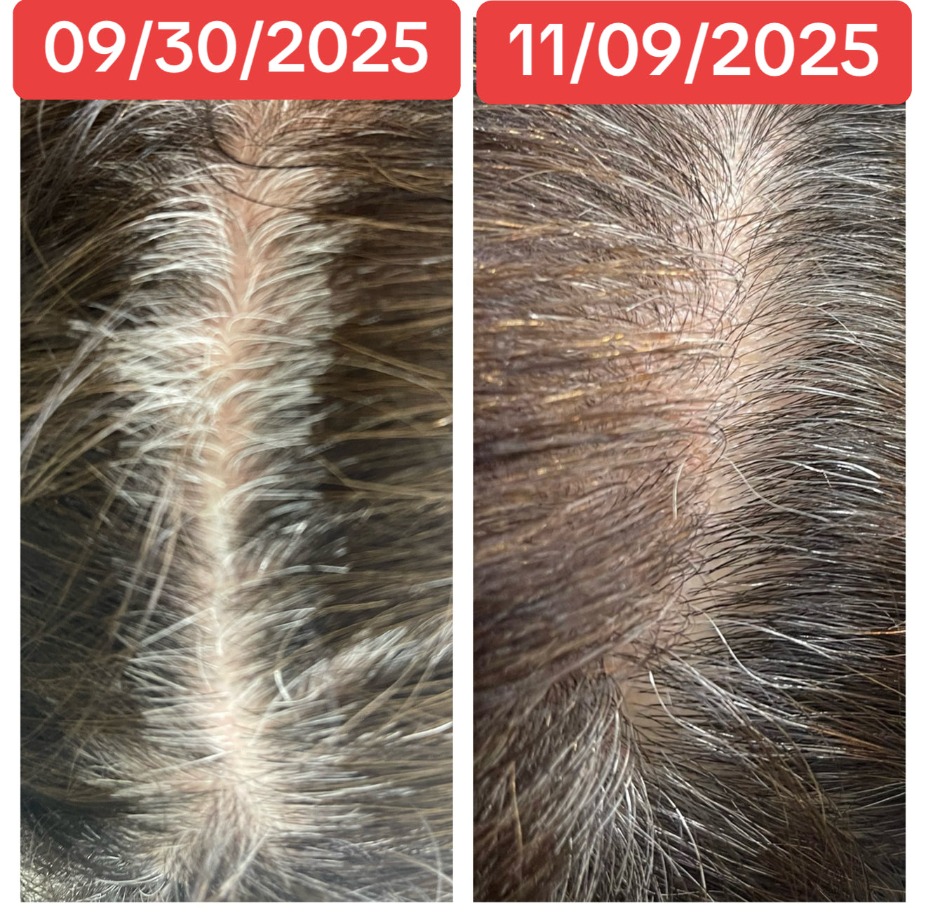One 2oz Anti-Gray Hair Serum/Bottle